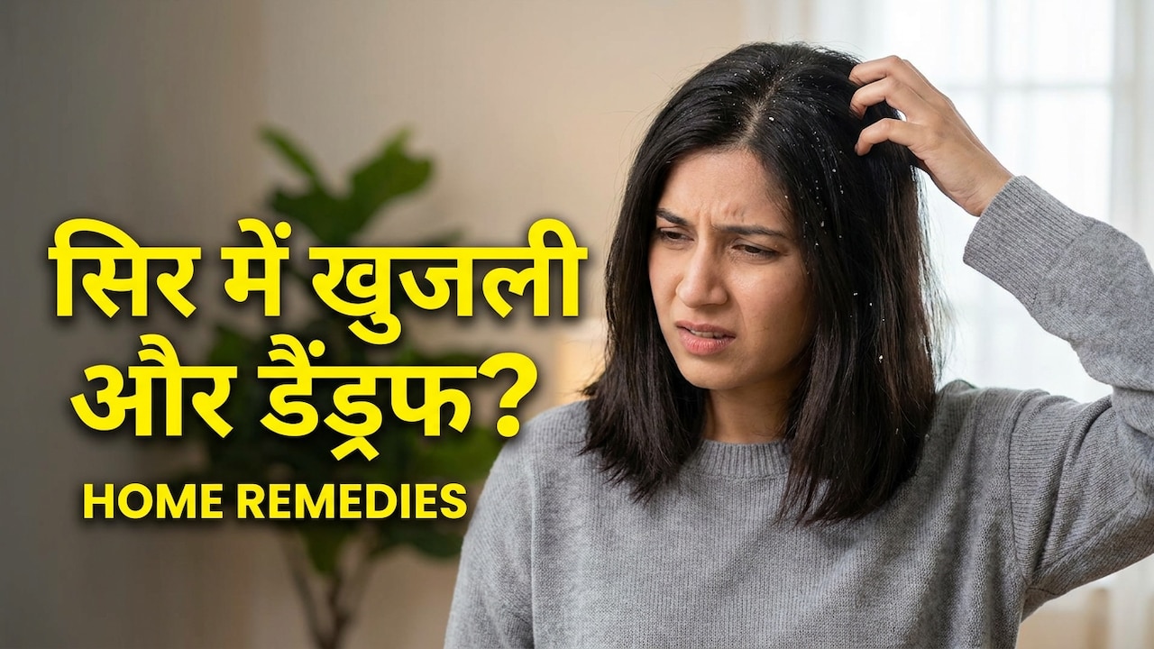 डैंड्रफ और खुजली से राहत पाने के लिए लोग आज भी अपनाते हैं ये नुस्खा, 2 चीज़ों के इस्तेमाल से झट से दिखेगा असर