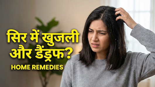 डैंड्रफ और खुजली से राहत पाने के लिए लोग आज भी अपनाते हैं ये नुस्खा, 2 चीज़ों के इस्तेमाल से झट से दिखेगा असर