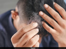 Ozempic Users Warned Over Hair Loss Linked to Weight Loss Jabs