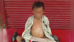 कुपोषण से 7 साल के आद&zwj;िवासी बच्&zwj;चे की मौत, डॉक्&zwj;टर ने बताया क&zwj;ितना खतरनाक और लक्षण