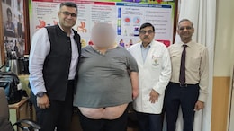 275 kg Delhi Teen Carried In 'Matador Van' To Hospital, Undergoes Complex Bariatric Surgery