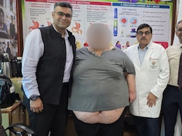 275 kg Delhi Teen Carried In 'Matador Van' To Hospital, Undergoes Complex Bariatric Surgery
