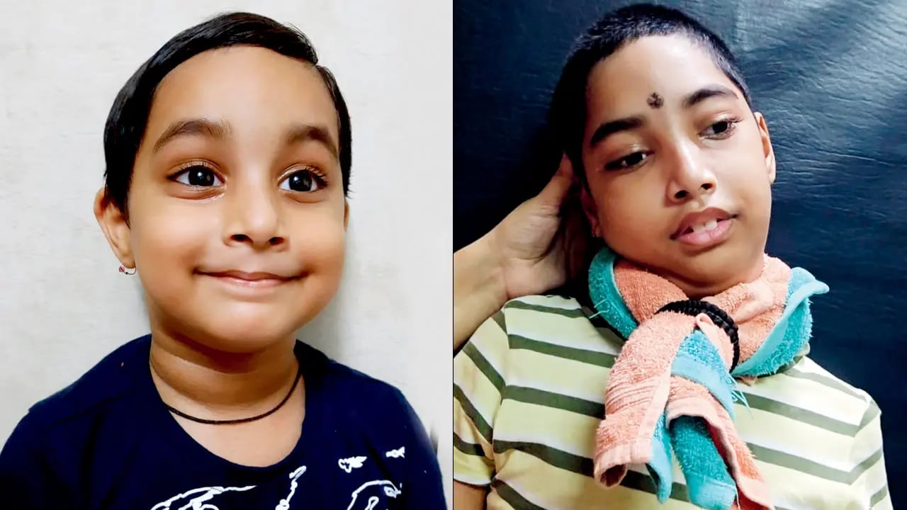 खसरे के सालों बाद सामने आई जानलेवा न्यूरोलॉजिकल बीमारी, 9 साल के बच्चे की कहानी झकझोर देगी