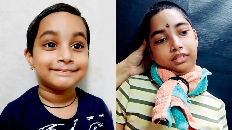 खसरे के सालों बाद सामने आई जानलेवा न्यूरोलॉजिकल बीमारी, 9 साल के बच्चे की कहानी झकझोर देगी