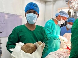 Doctors Remove 3.1 Kg And 17 Cm Urinary Bladder Stone From Patient, Claim Record