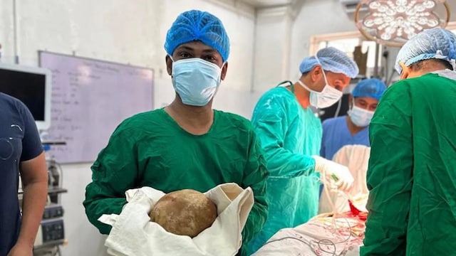 Bladder stones do not usually become this large when detected and treated early