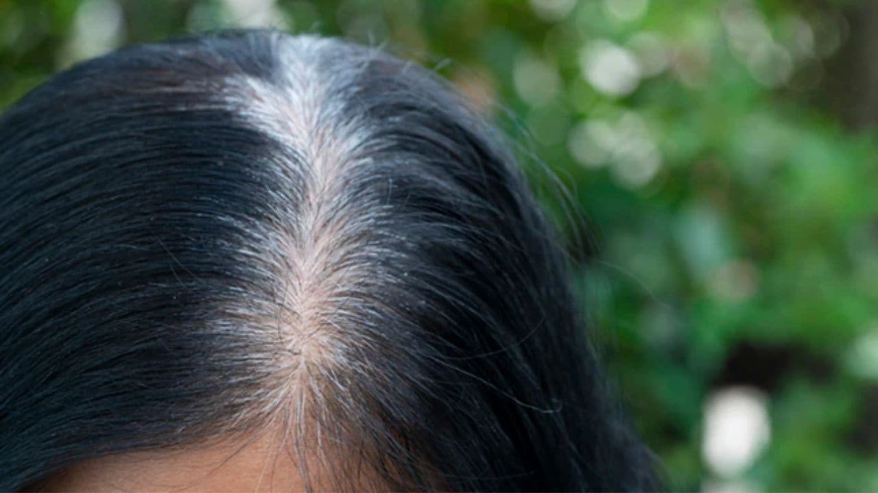 सफेद बालों को काला करने के लिए क्या लगाएं? सलीम जैदी ने बताए 3 असरादर नुस्खे, डाई करने की नहीं पड़ेगी जरूरत