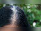 सफेद बालों को काला करने के लिए क्या लगाएं? सलीम जैदी ने बताए 3 असरादर नुस्खे, डाई करने की नहीं पड़ेगी जरूरत