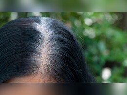सफेद बालों को काला करने के लिए क्या लगाएं? सलीम जैदी ने बताए 3 असरादर नुस्खे, डाई करने की नहीं पड़ेगी जरूरत