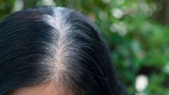 सफेद बालों को काला करने के लिए क्या लगाएं? सलीम जैदी ने बताए 3 असरादर नुस्खे, डाई करने की नहीं पड़ेगी जरूरत