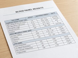Triglyceride-To-HDL Ratio: The Single Number On Your Blood Test That Predicts Heart Disease Risk