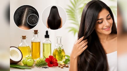 बालों के लिए सबसे अच्छा तेल कौन सा है? डर्मेटोलॉजिस्ट ने बताया डैंड्रफ और लंबे बालों के लिए कौन से Hair Oil हैं बेस्ट