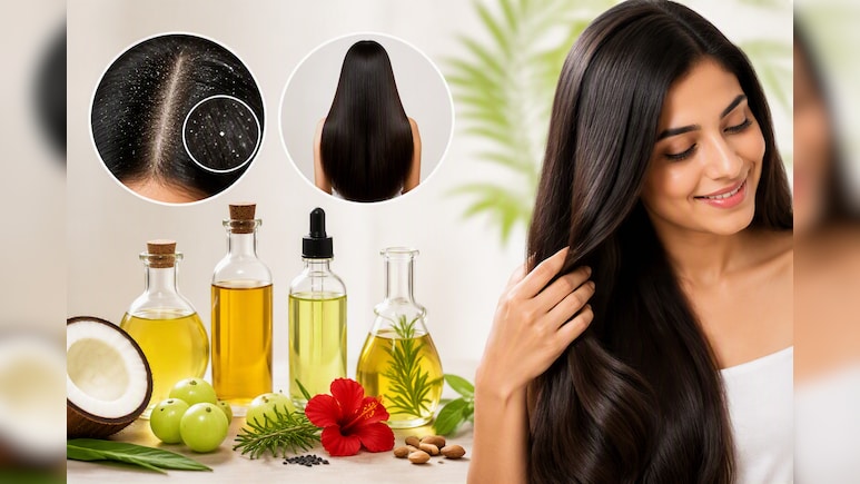 बालों के लिए सबसे अच्छा तेल कौन सा है?  डर्मेटोलॉजिस्ट ने बताया डैंड्रफ और लंबे बालों के लिए कौन से Hair Oil हैं बेस्ट