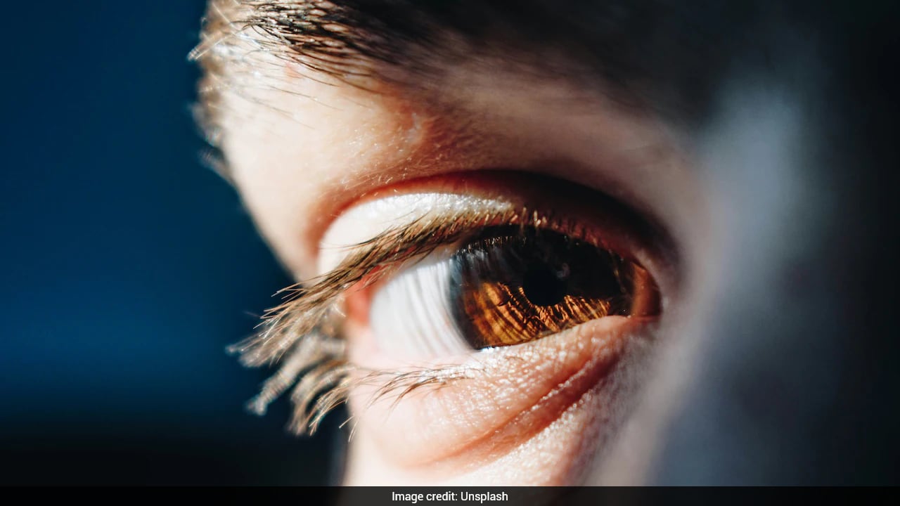 आंखों में बैठ आंख को ही खाता है ये पैरासाइट, शख्स ने बाली में की यह एक गलती और अब अंधे होने का डर
