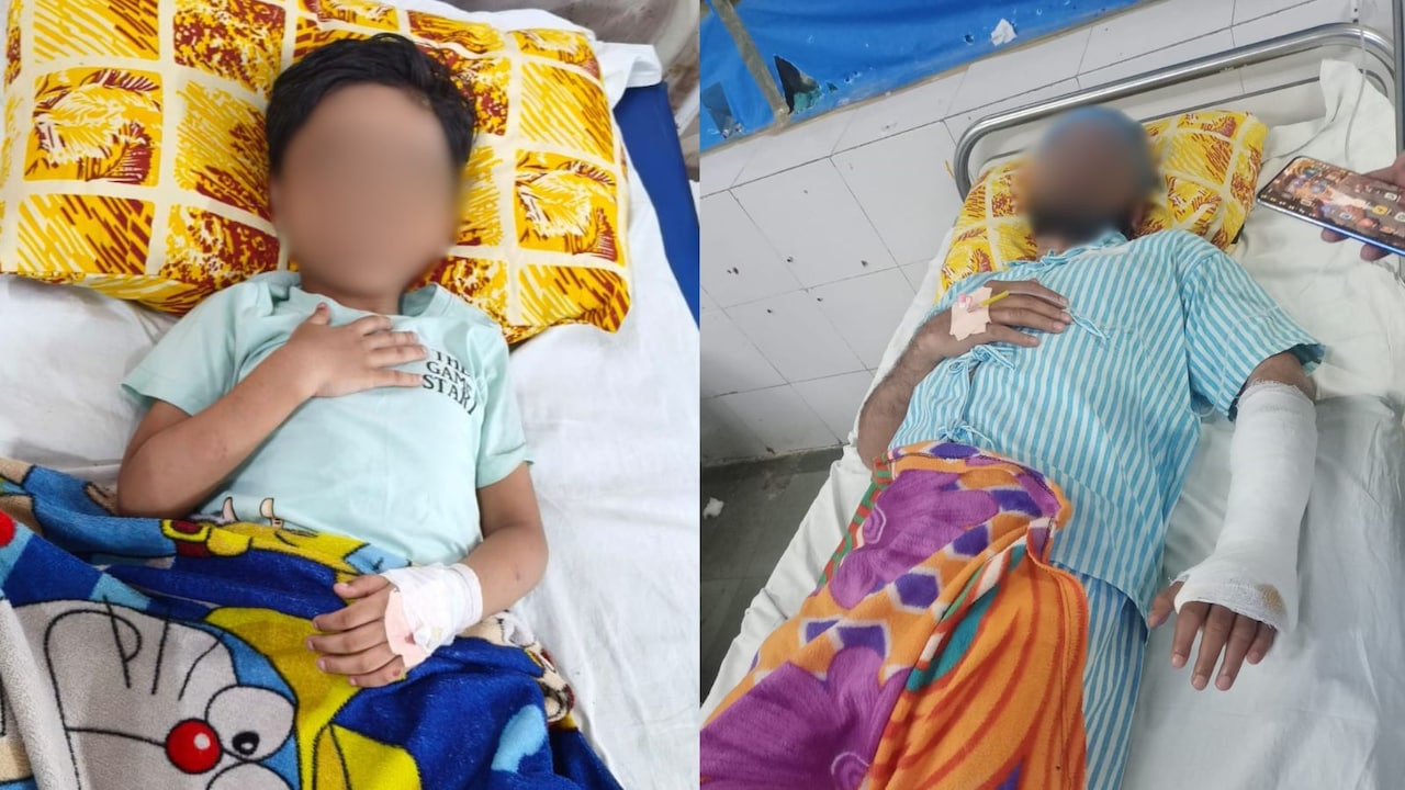 शरीर पर दांत से काटा, आंख में मारी पेंस‍िल, स्‍कूल में बच्चों की लड़ाई का वीडियो, शिकायत पर पिता का हाथ तोड़ा