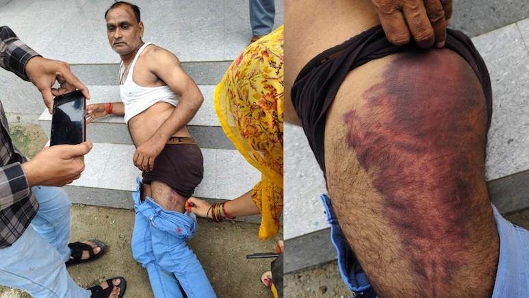 भिंड में MSP घोटाले का 'हिसाब' मांगने पहुंचे किसानों ने सहायक सचिव को 13 घंटे बनाया बंधक, बेसबॉल बैट से पीटा