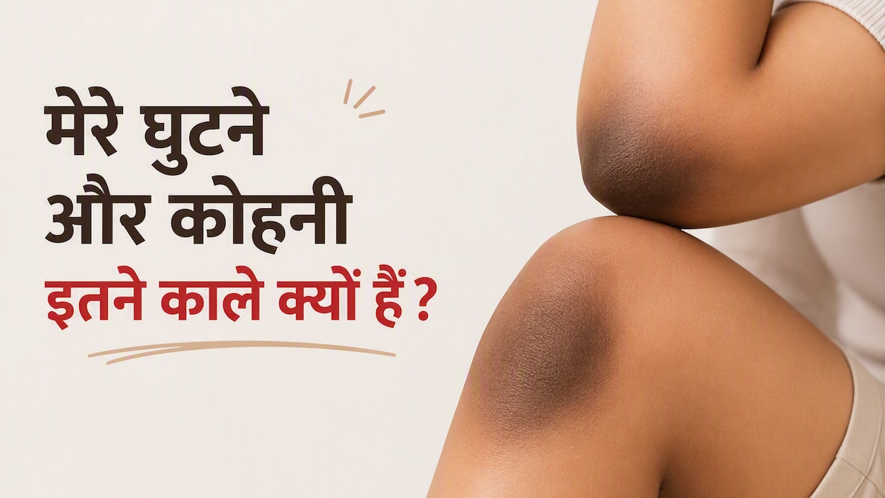 मेरे घुटने, कोहनी और उंगलियां इतनी काली क्यों हैं? शरीर की ये छिपी समस्याएं हो सकती हैं वजह