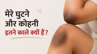 मेरे घुटने, कोहनी और उंगलियां इतनी काली क्यों हैं? शरीर की ये छिपी समस्याएं हो सकती हैं वजह