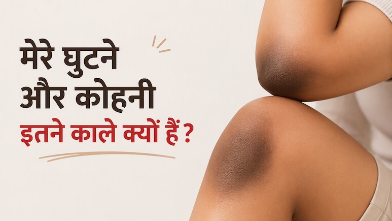 मेरे घुटने, कोहनी और उंगलियां इतनी काली क्यों हैं? शरीर की ये छिपी समस्याएं हो सकती हैं वजह
