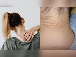गर्दन और पीठ के मैल को साफ करने की आसान टिप्स, घर पर बनाएं बेसन-दही का नेचुरल क्लींजर