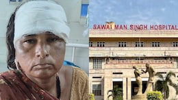 महिला गई थी SMS हॉस्पिटल, सिर पर गिर गया पंखा, लगे 12 टांके