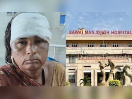 महिला गई थी SMS हॉस्पिटल, सिर पर गिर गया पंखा, लगे 12 टांके