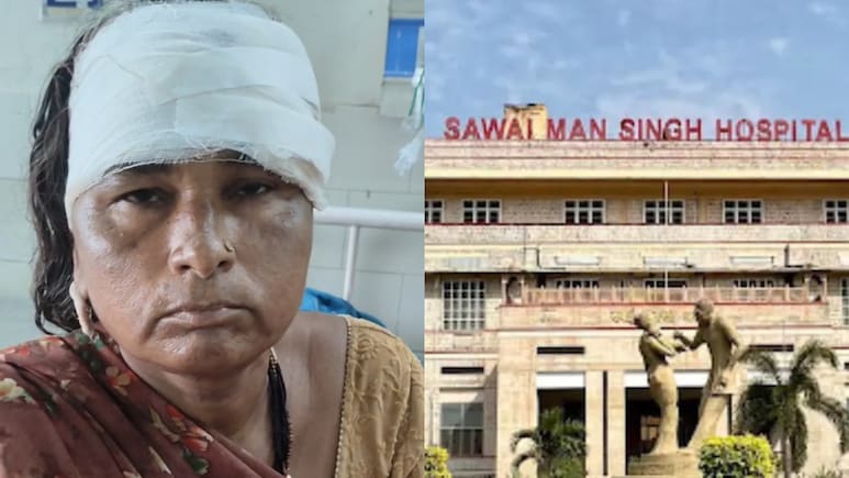 महिला गई थी SMS हॉस्पिटल, सिर पर गिर गया पंखा, लगे 12 टांके