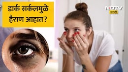 Dark Circles Home Remedy: डोळ्यांखालील डार्क सर्कल  काही दिवसांत गायब, घरच्या घरी तयार करा नॅचरल आय क्रीम