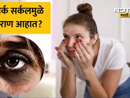 Dark Circles Home Remedy: डोळ्यांखालील डार्क सर्कल  काही दिवसांत गायब, घरच्या घरी तयार करा नॅचरल आय क्रीम