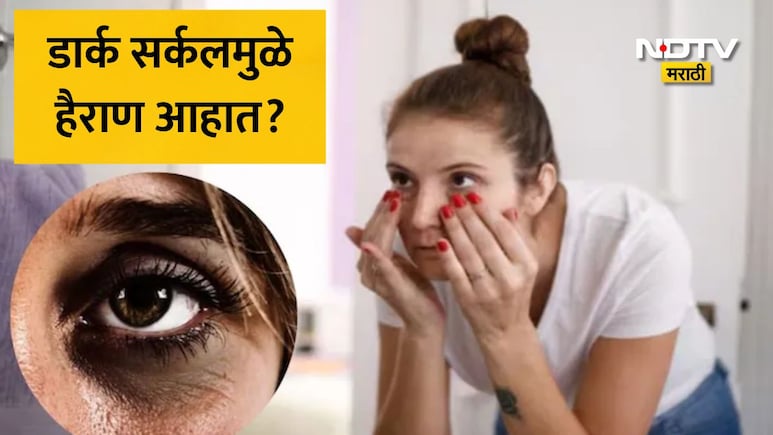 Dark Circles Home Remedy: डोळ्यांखालील डार्क सर्कल  काही दिवसांत गायब, घरच्या घरी तयार करा नॅचरल आय क्रीम