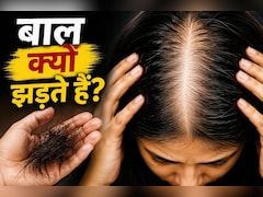 Hair Fall Reason: आयरन, Vitamin D या B12? जानिए किस कमी से सबसे ज्यादा झड़ते हैं बाल