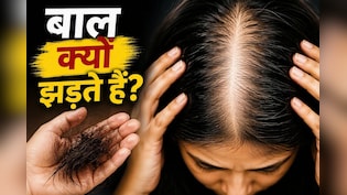 Hair Fall Reason: आयरन, Vitamin D या B12? जानिए किस कमी से सबसे ज्यादा झड़ते हैं बाल