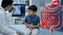 क्या आपके बच्चे के पेट में हो रहा है दर्द? भूलकर भी करें इग्नोर,अपेंडिसाइटिस की देर से पहचान बढ़ा सकता है खतरा