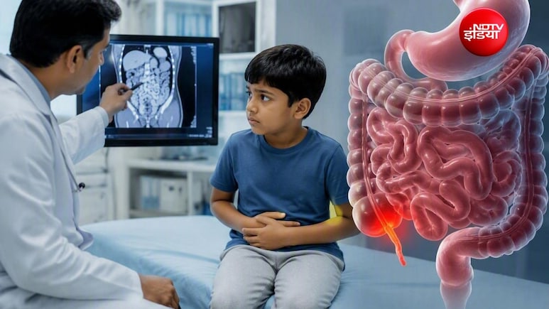 क्या आपके बच्चे के पेट में हो रहा है दर्द? भूलकर भी करें इग्नोर,अपेंडिसाइटिस की देर से पहचान बढ़ा सकता है खतरा