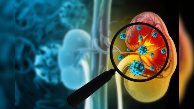From 6,000 To Over 18,000: Karnataka Sees Rise In Death From Kidney, Urinary Diseases Over 10 Years| Report