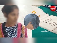 महिला के पेट से निकली 6 सुईयां, छलनी हो गई थी आंत,  इस बीमारी के चलते खा रही थी, कांच, मिट्टी... जैसी चीजें