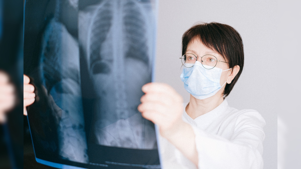 Chinese Man Goes To Hospital With Blood In Urine, Doctors Find 36mm Needle In His Heart