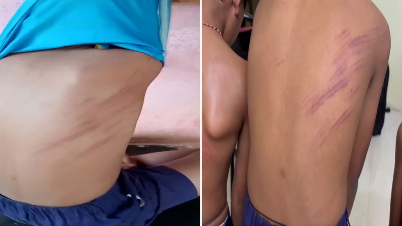 Karnataka Teacher Accused Of Beating Students Over Low Marks