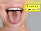 गर्म खाने से जीभ जल जाए तो तुरंत क्या करें? एक्सपर्ट ने बताया कैसे जल्दी होगी ठीक