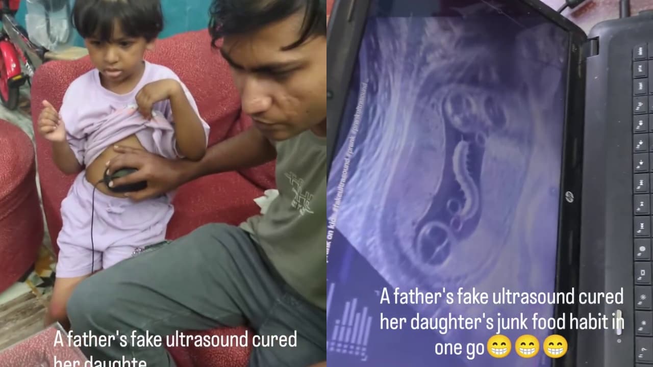 जंक फूड की आदत छुड़ाना चाहता था पिता, माउस से किया बेटी का फेक 'अल्ट्रासाउंड'; पेट में कीड़े देख रो पड़ी बच्ची