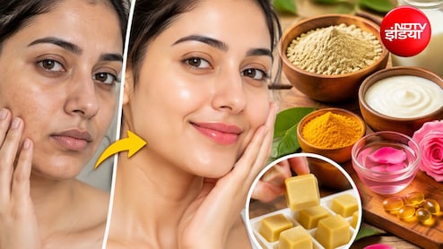 चेहरे को बनाना है ग्लोइंग और सोफ्ट? आज ही अपनाएं मुल्तानी मिट्टी और दूध-दही वाला ये घरेलू नुस्खा, तरोताजा हो जाएगी स्किन