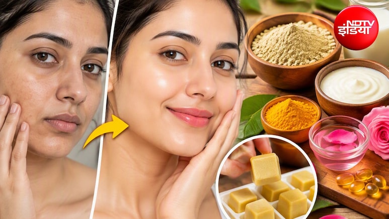 चेहरे को बनाना है ग्लोइंग और सोफ्ट? आज ही अपनाएं मुल्तानी मिट्टी और दूध-दही वाला ये घरेलू नुस्खा, तरोताजा हो जाएगी स्किन