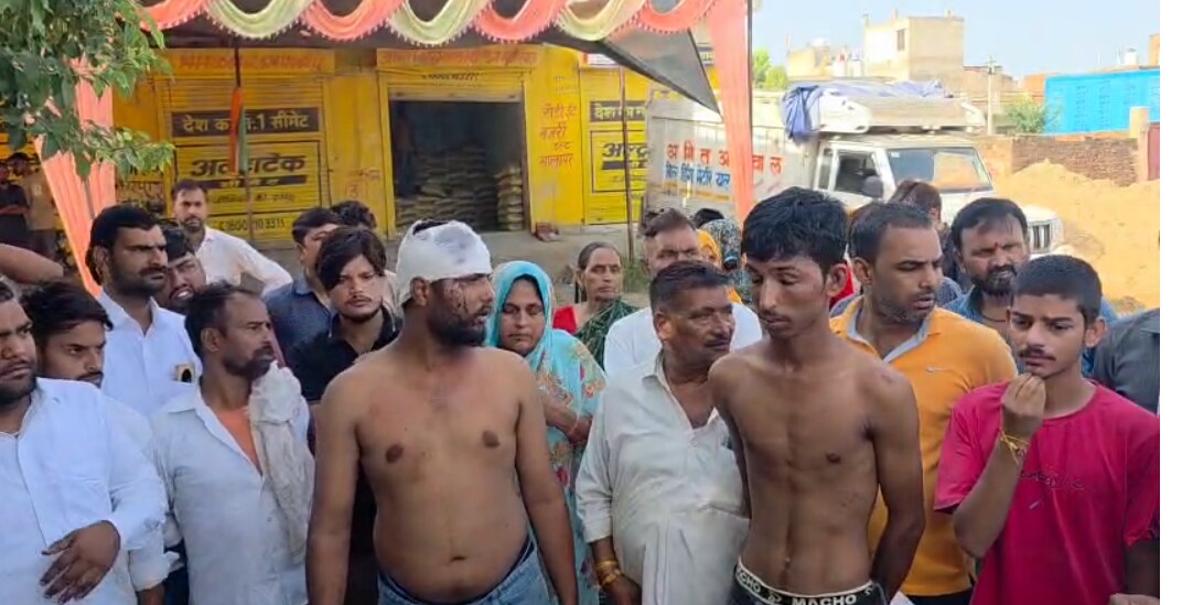 अलवर के वार्ड 43 में हुई मारपीट में युवक घायल हो गया. अलवर के वार्ड 43 में हुई मारपीट में युवक घायल हो गया.
