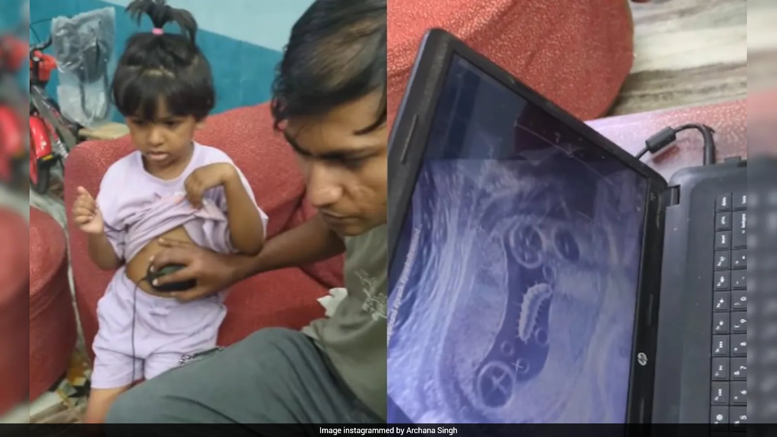 Father's Fake Ultrasound to Deter Daughter from Junk Food Sparks Social Debate