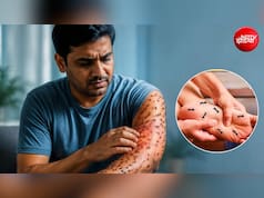 शरीर पर चींटी चलने जैसा महसूस होने का क्या कारण है?