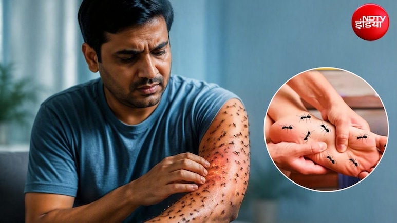 शरीर पर चींटी चलने जैसा महसूस होने का क्या कारण है?