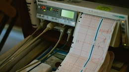 Heart Patients: 5 Simple Tests That Can Detect Hidden Kidney Disease