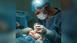 TikTok Trend Turns Nightmare As Women Share Horror Stories After 'Bleph' Surgery: "Unable To Close Eyes"