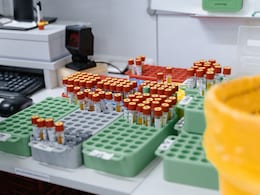 H1N1 Cases Surge In Uttar Pradesh: Where To Get Free Tests In India