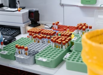 H1N1 Cases Surge In Uttar Pradesh: Where To Get Free Tests In India
